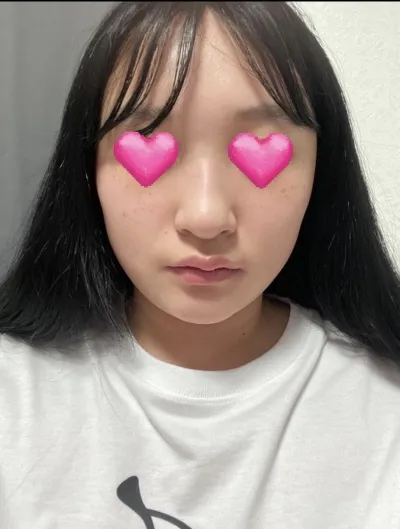 [코] 밍카인 - 코