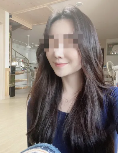 [안면윤곽] singga - 광대,턱끝