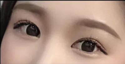 [눈] sidhd22 - 뒤트임,밑트임