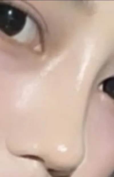 [코] 메롱망고 - 코