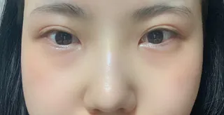 [코] 핑쿠팬더 - 눈,코