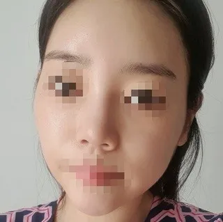 [코] 핑크색 - 코,윤곽