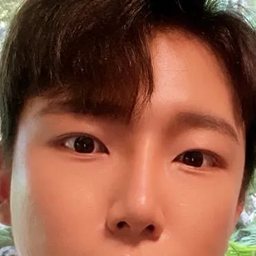 [남자] Aiden - 매몰, 눈밑지방재배치, 코