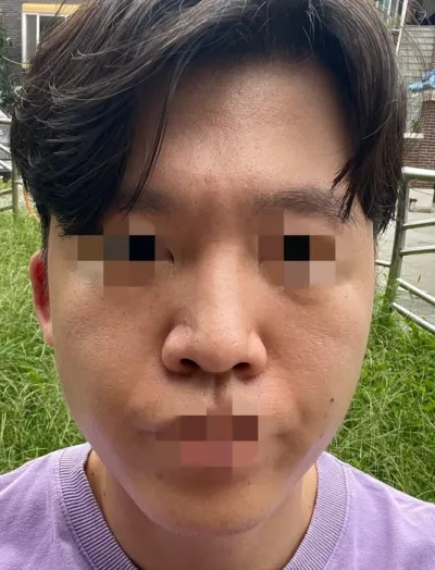 [남자] 조앤 - 코,윤곽