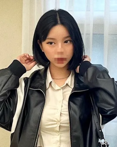 [안면윤곽] Asher - 윤곽2종