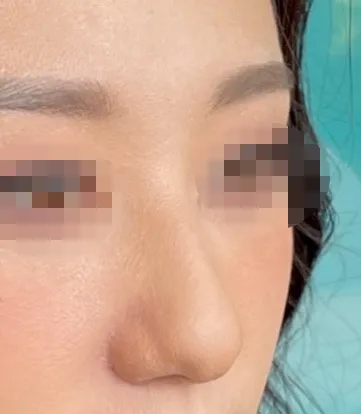 [코] 블랙팬서 - 코