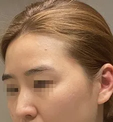 [코] 옥탑방고양이 - 코