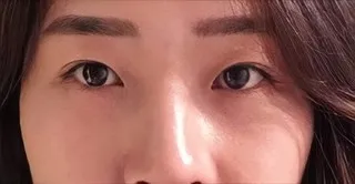 [눈] 닥터자르트 - 눈