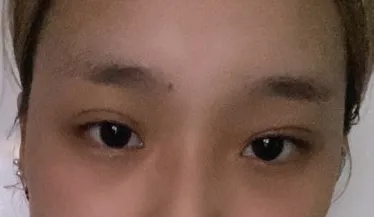 [코] 멜로디 - 윤곽,눈,코