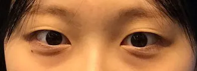 [눈] 코카콜라 - 눈