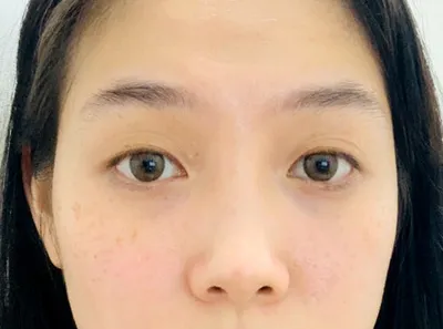 [눈] 벧걸 - 눈,코