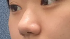 [코] 빚과부 - 코,광대