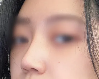 [코] 급제동 - 코