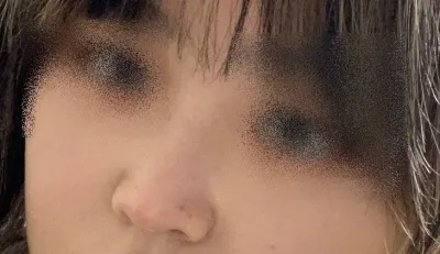 [코] 조라슬v - 코