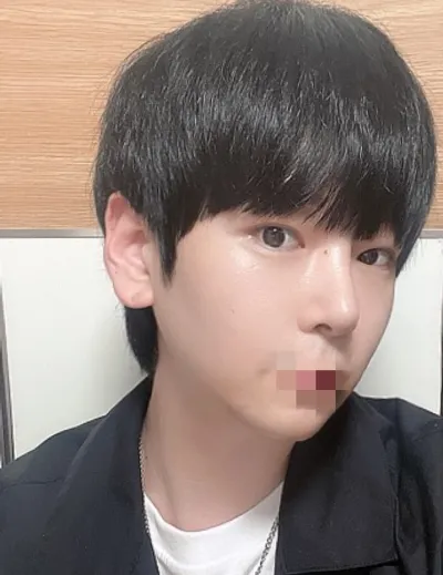 [코] 타게트 - 코