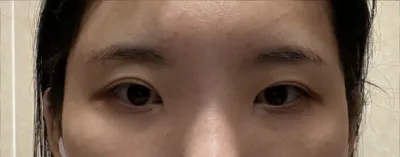 [눈] 모든게다 - 눈