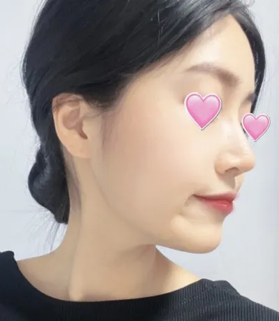 [코] 베비폭스 - 코