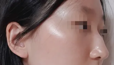 [코] 피노끼오 - 코