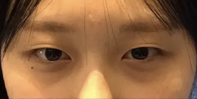 [눈] 얼레리 - 눈