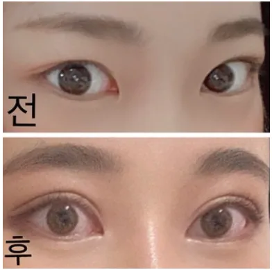 [눈] 호호바 - 눈,코,이마거상