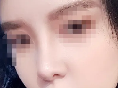 [코] 아아조아 - 코