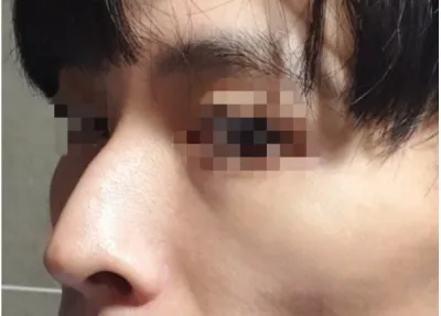 [코] 하루사리 - 코