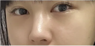 [눈] 빨강이 - 눈, 코