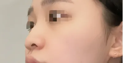 [코] 찌룽해 - 코