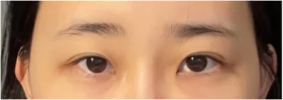 [눈] 유성매직 - 눈