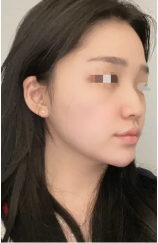 [코] 러브유 - 코