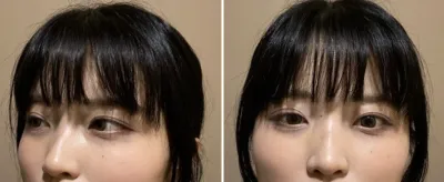 [코] 얄쌍한코 - 코