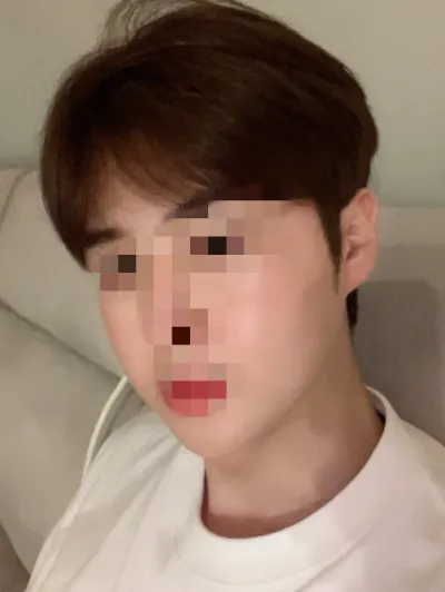 [안면윤곽] 포스틑잇 - 윤곽