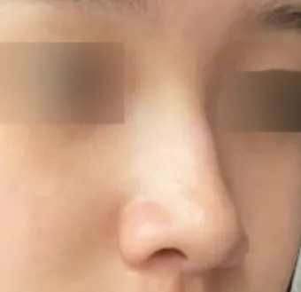 [코] 가리브 - 코