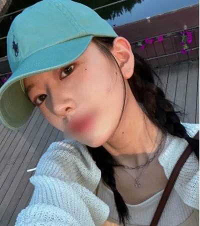 [코] 망나뇽 - 코