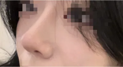 [코] 유리조각 - 코