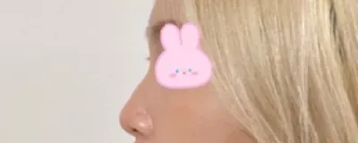 [코] 벤쿠버 - 코