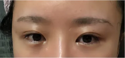 [눈] 마피아 - 눈