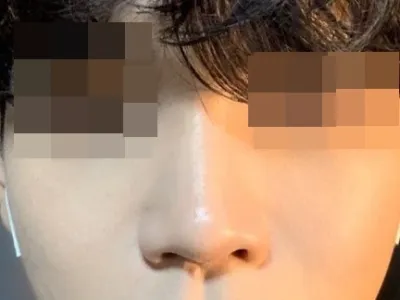 [코] 정다운우리집 - 코