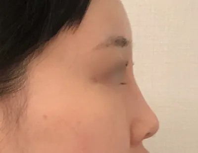 [눈] 촉호케이쿠 - 눈,코