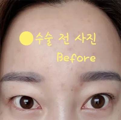 [눈] 아메숏헤어 - 눈