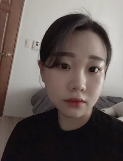 [안면윤곽] 냐나냐나냥 - 광대, 사각턱, 턱끝