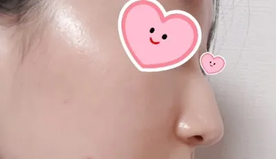 [코] 빼꼼이 - 코