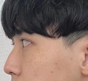 [코] 힙힌지 - 코