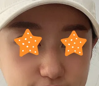 [코] 하아아아품 - 코