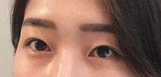 [눈] 그래도 - 눈