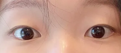 [눈] 꼬부기 - 눈