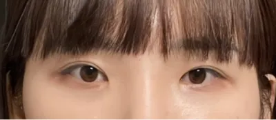 [눈] 데일리아이 - 눈