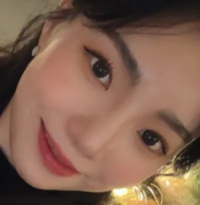 [코] 몽글구름 - 코,지방이식