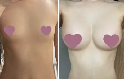 [가슴] 뒤집어라어퍼라 - 가슴