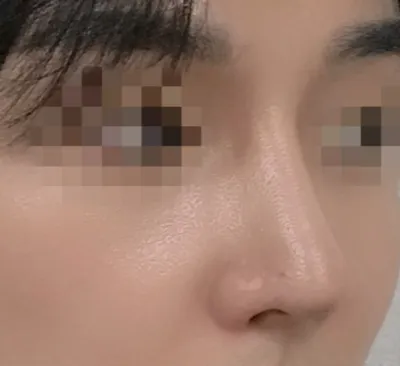 [코] 나는켈리 - 코